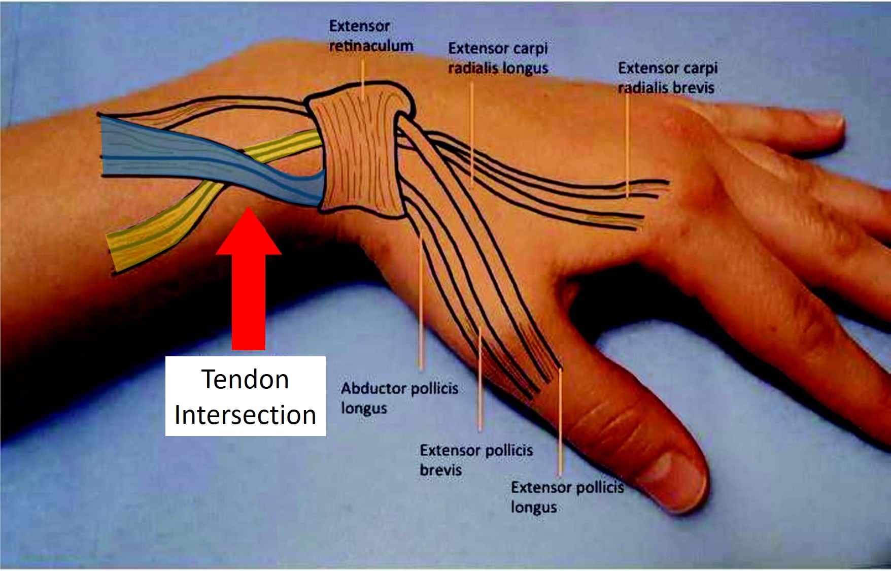 Как расположены сухожилия на пальцах рук фото