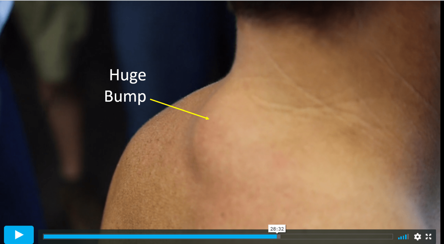 Brimhall Wellness Stem Cell Course A Review Regenexx