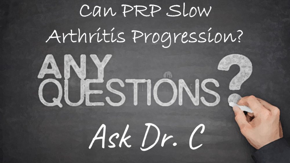 Ask Dr. C-Episode 11-Can PRP Reduce Arthritis Progression?