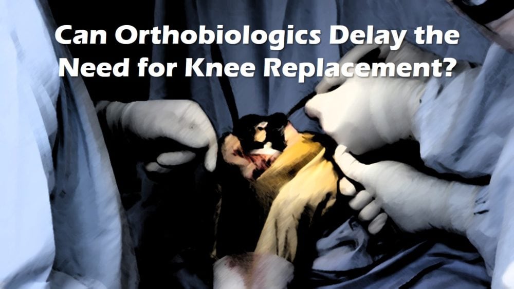 PRP and BMC Delay the Need for Knee Replacement