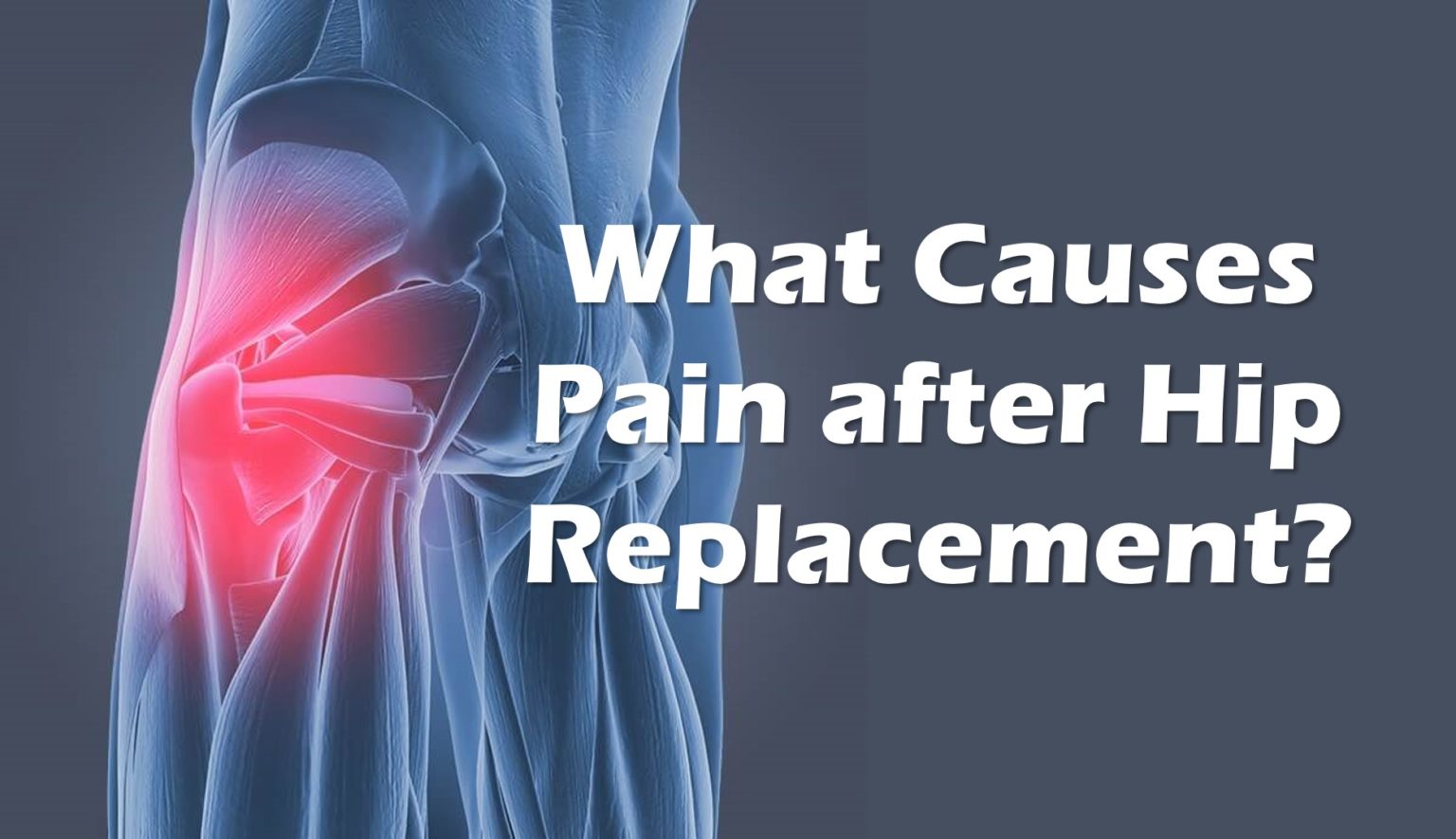 Pain after Hip Replacement? Is It Your Tendons? Regenexx