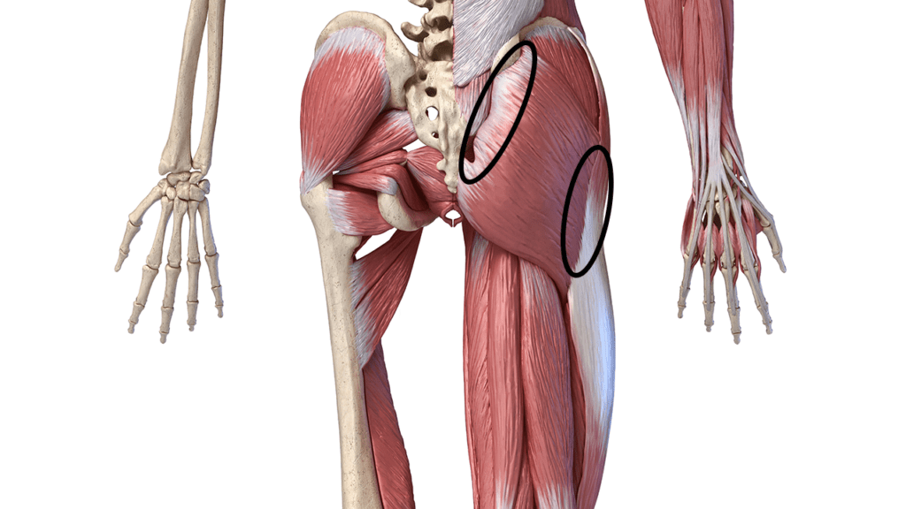 i-had-a-hip-replacement-so-why-do-i-still-have-groin-pain-the