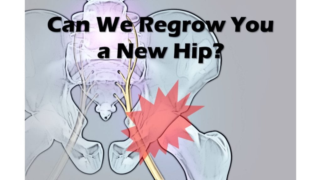 regrow hip with stem cells