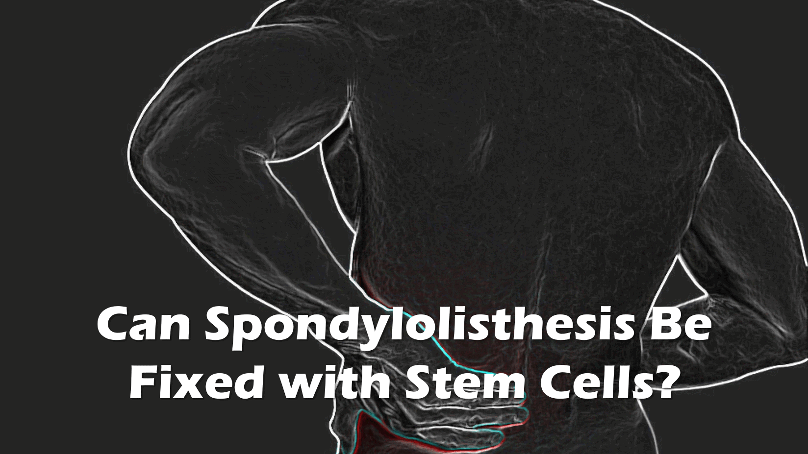 spondylolisthesis stem cells