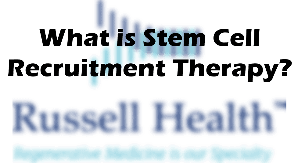 Stem Cell Recruitment Therapy?