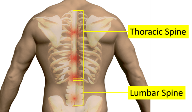 what-type-of-cancer-causes-back-pain-youtube