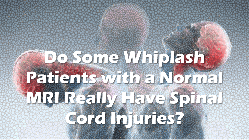 New Study: Some Chronic Whiplash Patients Have Spinal Cord Injuries