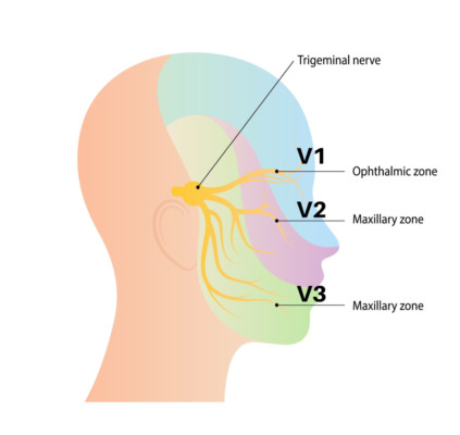 Illustration of trigeminal nerve anatomy showing the nerves orgin in the brain and corresponding zones in the face