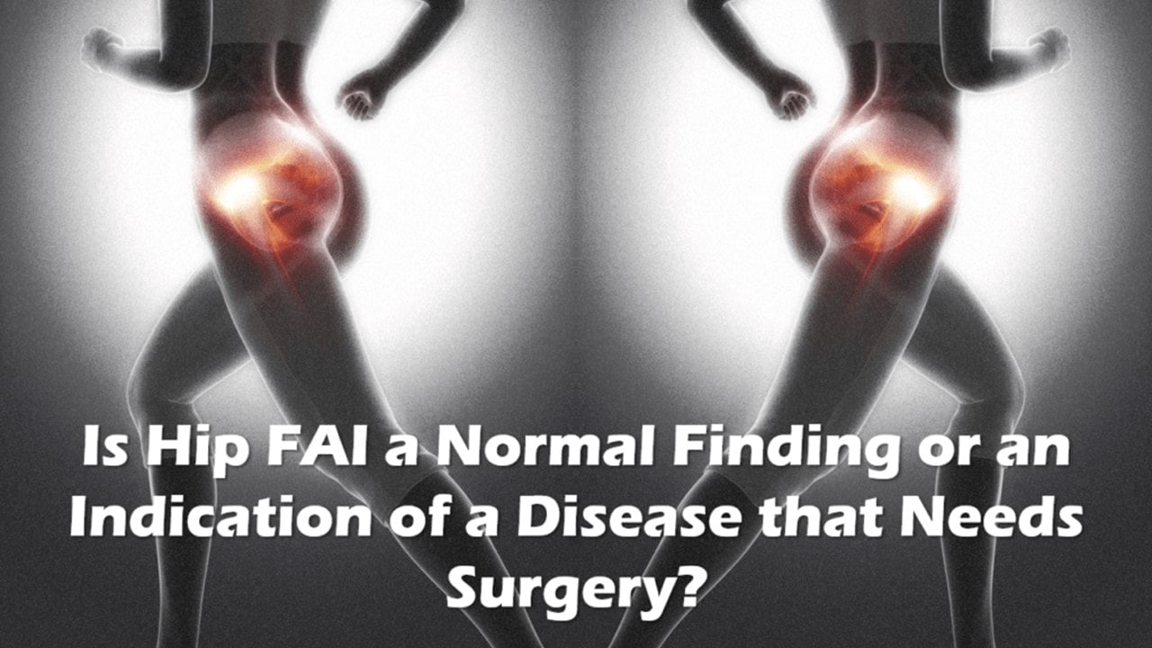 hip FAI surgery side effects
