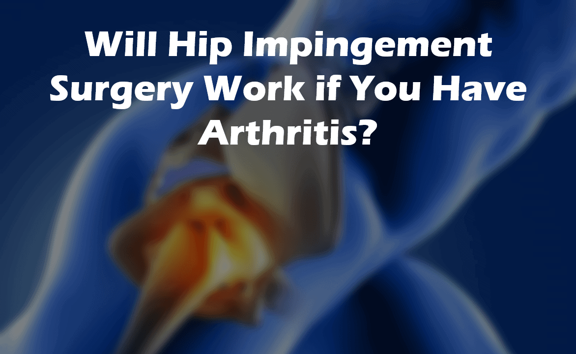hip impingement arthritis