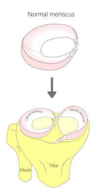 Anatomy of a proximal surface of the tibia with meniscus in the healthy human knee joint.