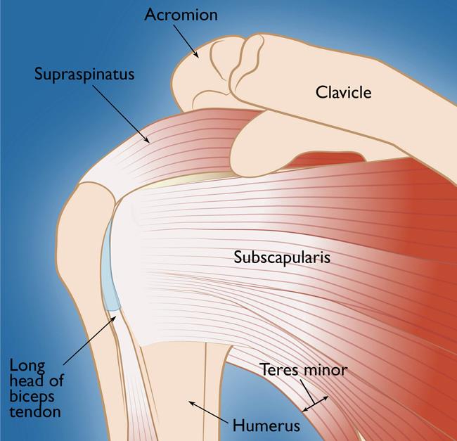 Does a Partial Rotator Cuff Tear Get Bigger Over Time? - Regenexx