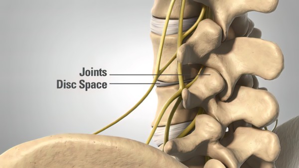 3D Medical illustration Human Skeleton, Disc space and Joints. Disc space narrowing and the lumbar facet joints