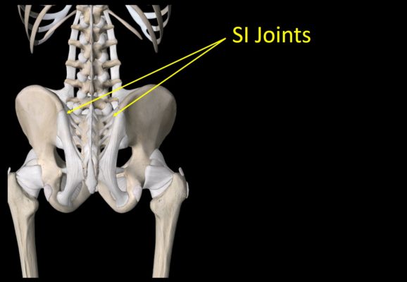 SI Joint Fusion Complications? Why Are We Doing this to Patients ...