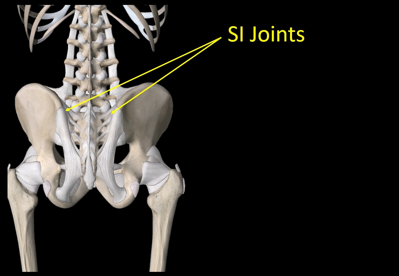 SI Joint Fusion Complications? Why Are We Doing this to