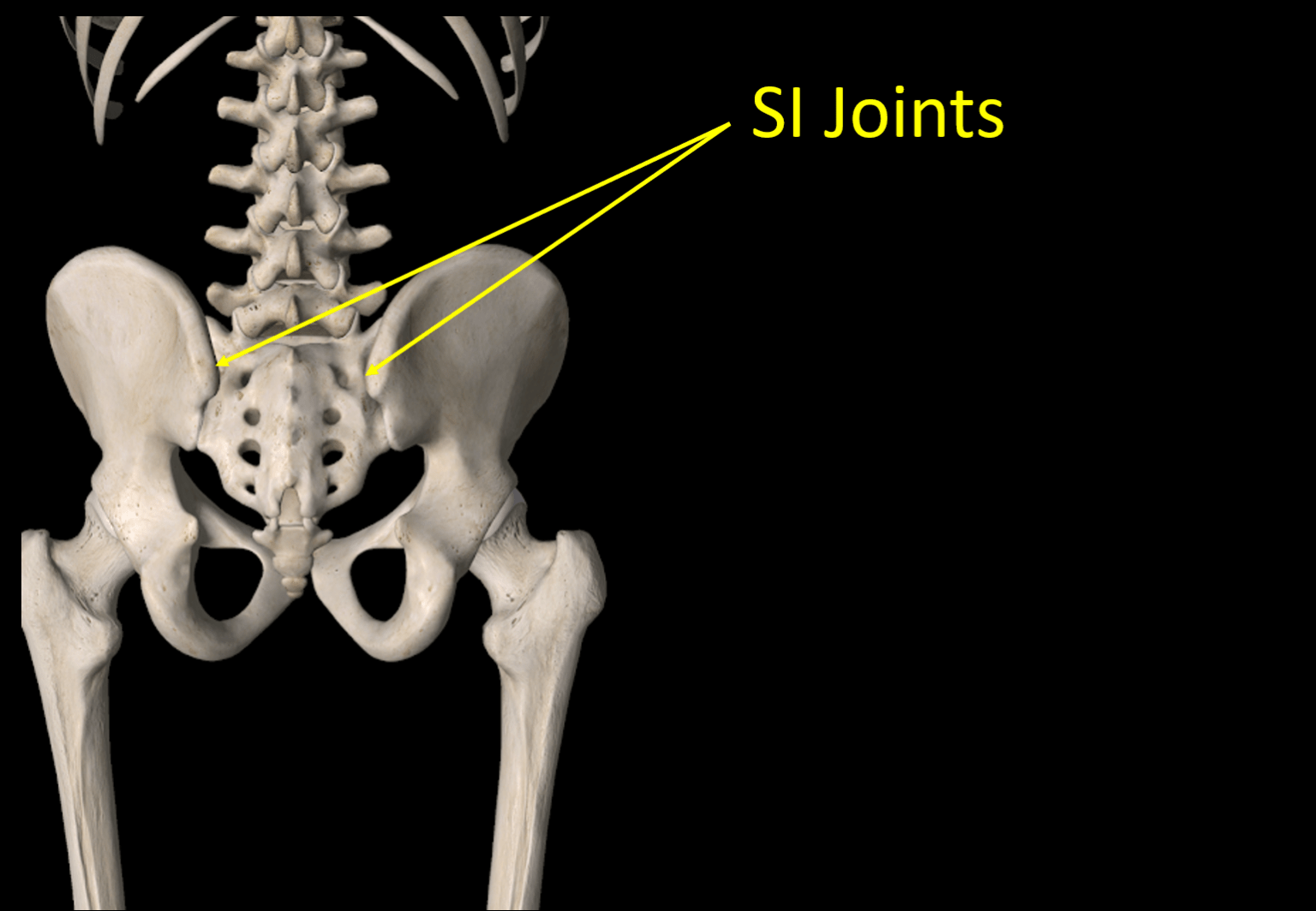 SI Joint Fusion Complications? Why Are We Doing this to