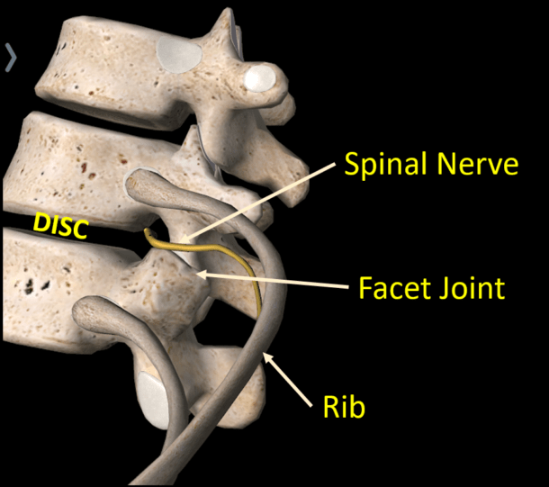 What Is Thoracic Radiculopathy? - Regenexx