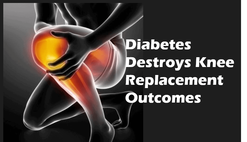 Diabetes Impacts Knee Replacement Outcome - Regenexx