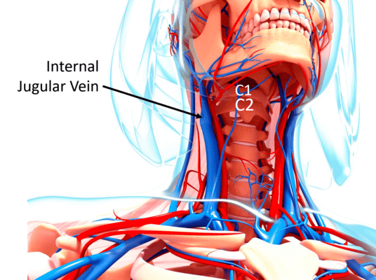 medically accurate illustration of the throat anatomy with an arrow pointing to jugular vein compression