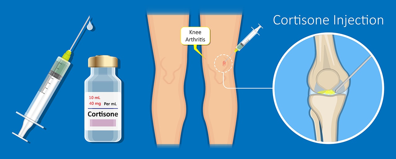 More Information that High Dose Steroids Are Bad News for Joints Regenexx