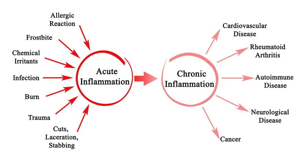 how-quickly-do-you-resolve-inflammation-regenexx