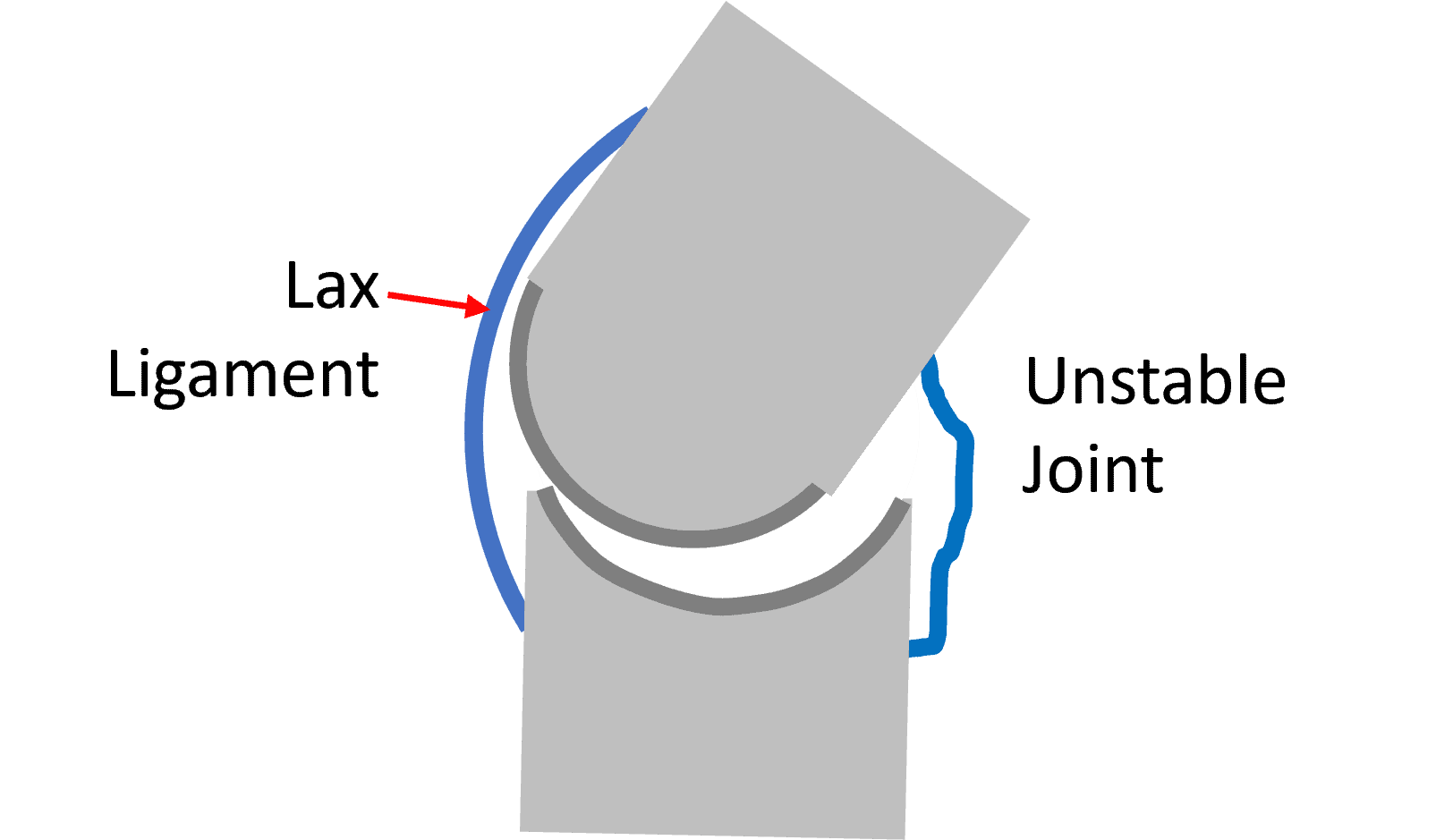 Joint Sounds and How Ligaments Respond to Orthobiologics Regenexx