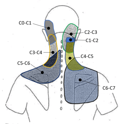 What's the Purpose of a Neck Facet Injection? - Regenexx