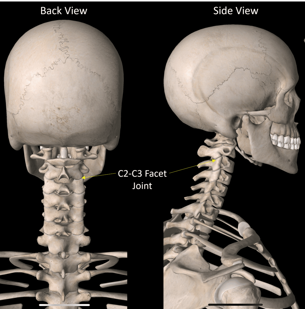 facet-joint-injuries-my-family-physio