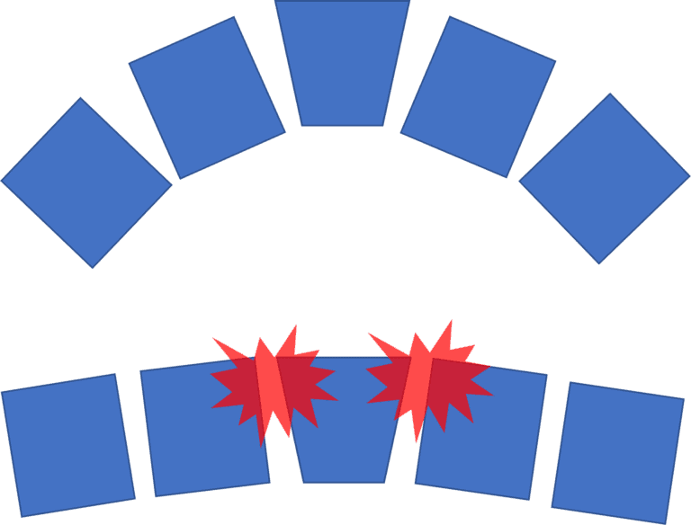 Getting Flat Feet? Meet the Spring Ligament Regenexx