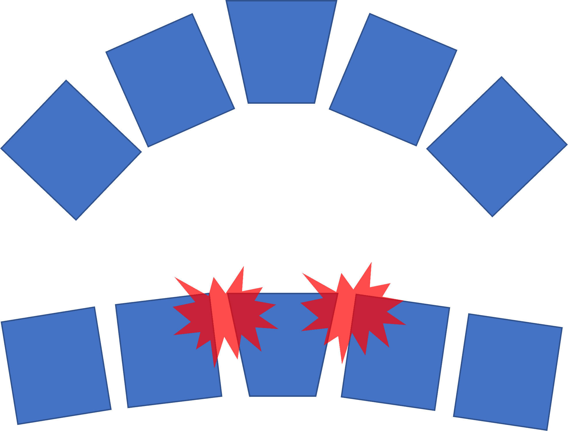 Getting Flat Feet? Meet the Spring Ligament Regenexx