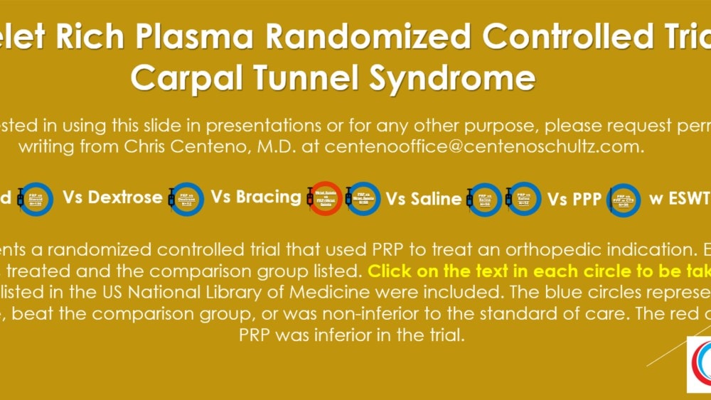 Can PRP Be Used to Treat Carpal Tunnel Syndrome?