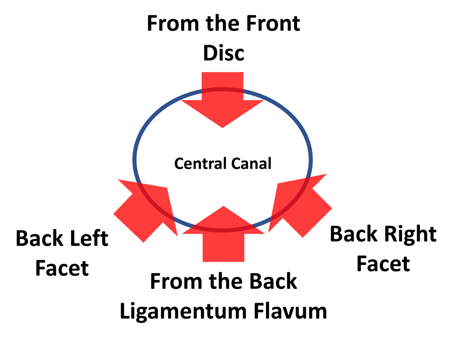 What is the Ligamentum Flavum? Why Should You Care? Regenexx