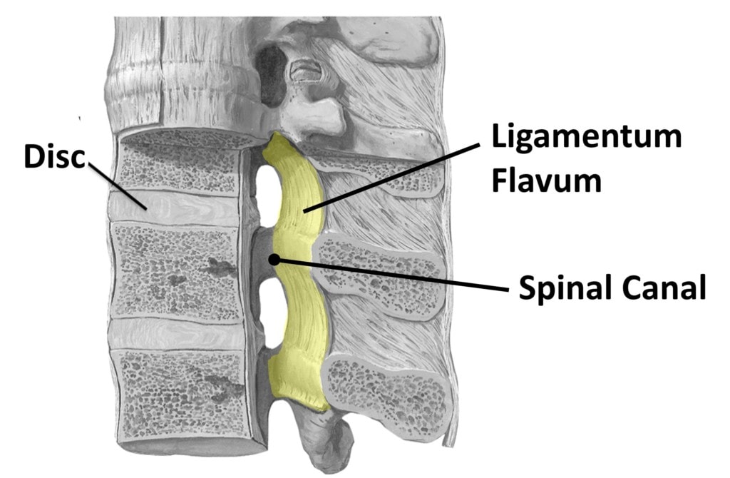 ligamentum flavum cadaver