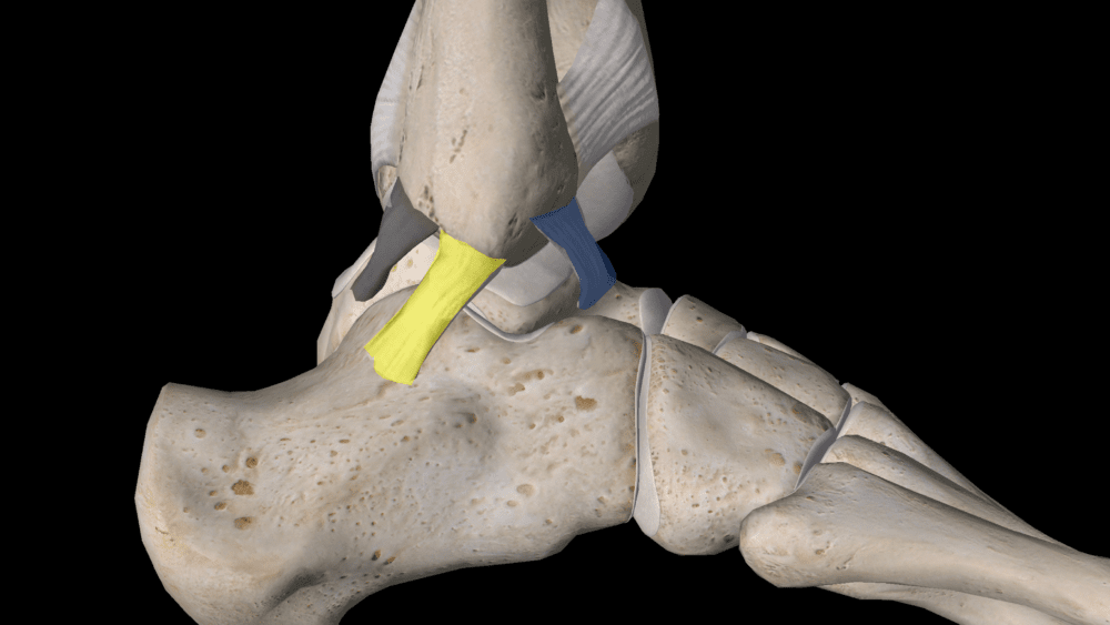 1 in 3 Unstable Ankles Has Cartilage Damage