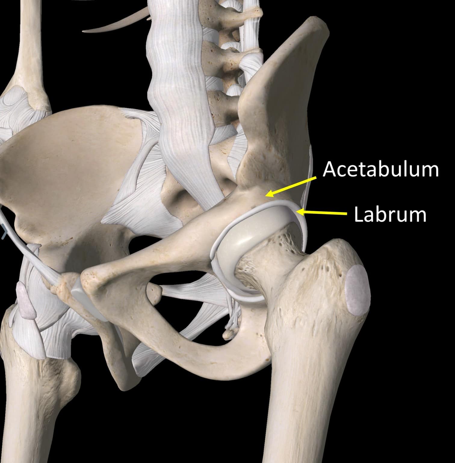 treating-an-acetabular-cyst-and-healing-the-hip-socket-regenexx