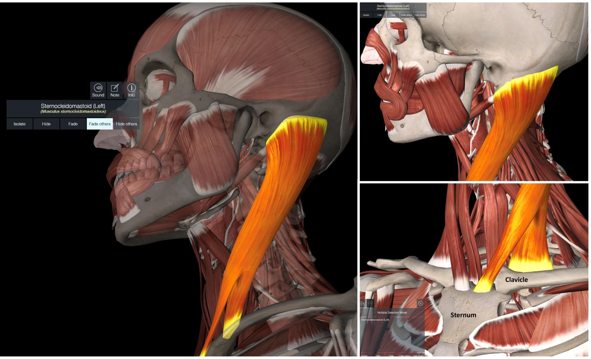 sternocleidomastoid-syndrome-what-you-need-to-know-regenexx