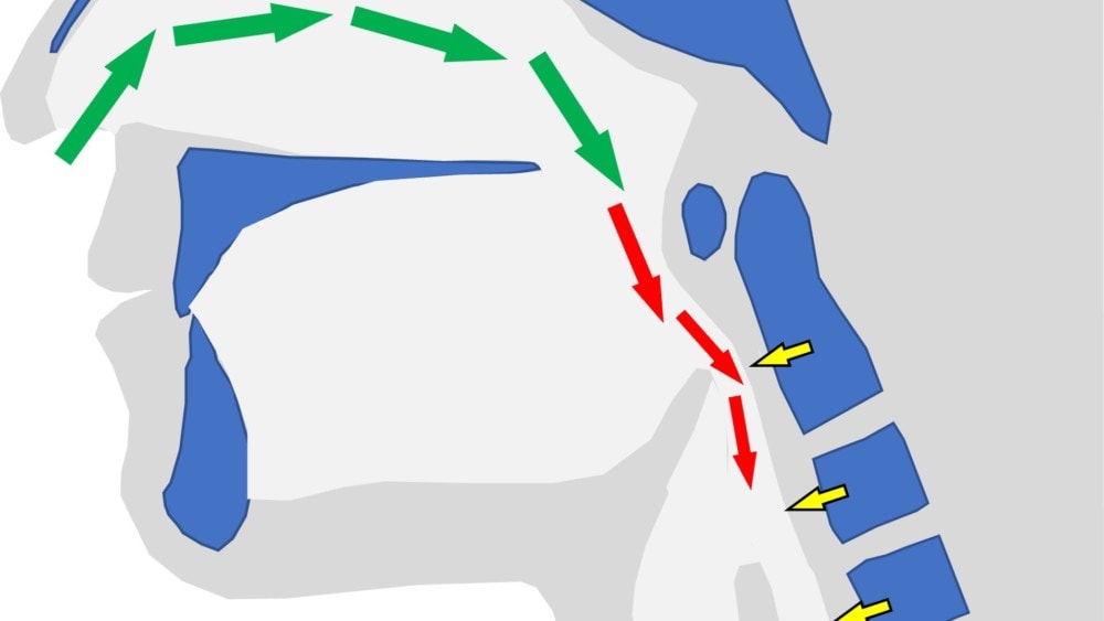 Is Your Snoring Being Caused by Your Neck?