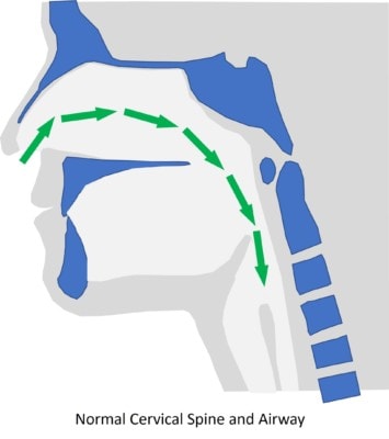 Is Your Snoring Being Caused by Your Neck? - Regenexx