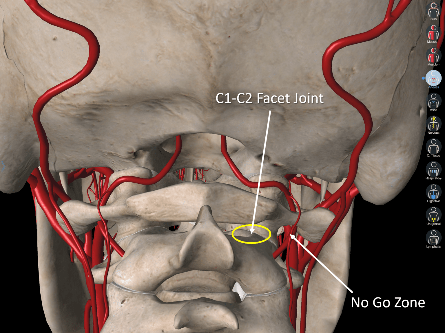 Injecting the C1C2 Facet Joint Under Ultrasound A PA with a Scary Big Needle Regenexx
