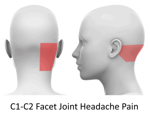 How Does the Body Stabilize the C1-C2 Joint? The Role of the Alar ...