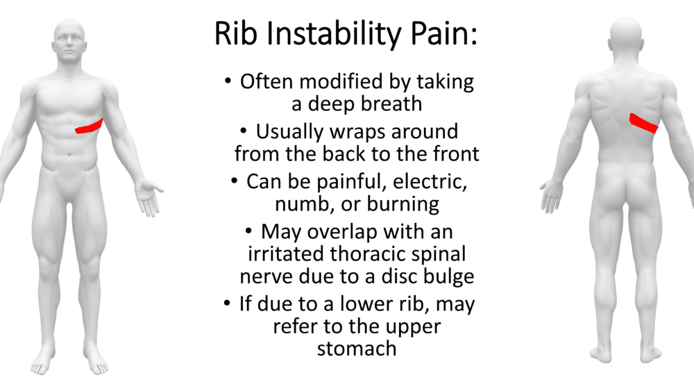 What is Slipping Rib Syndrome?