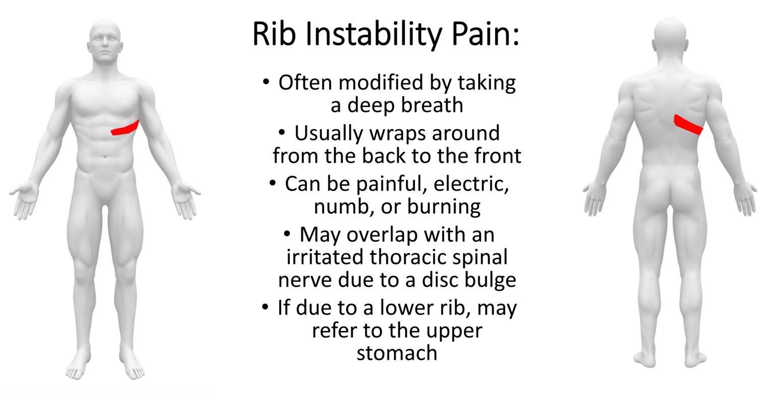 What is Slipping Rib Syndrome? Regenexx