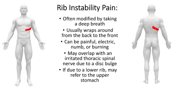 What Is Slipping Rib Syndrome Regenexx 1418