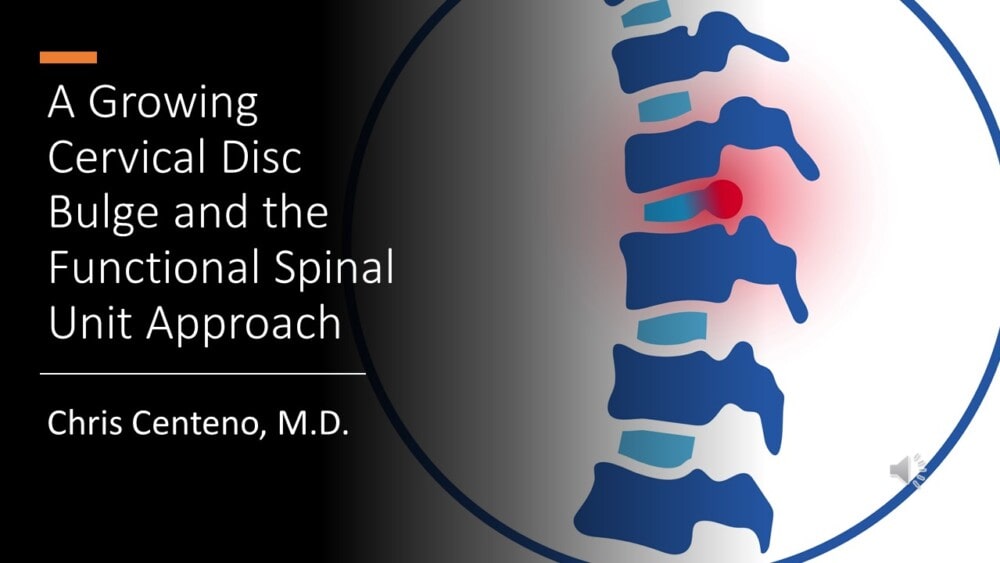 Here’s Another Video: How Can We Treat a Growing Cervical Disc Bulge?