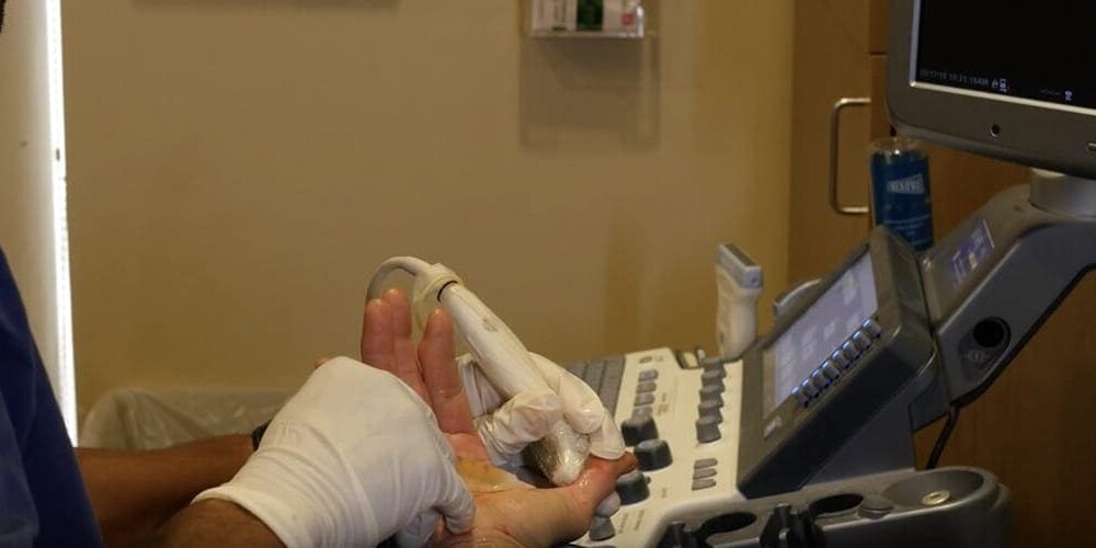 ​Thumb Osteoarthritis Treatments in Bellevue, WA