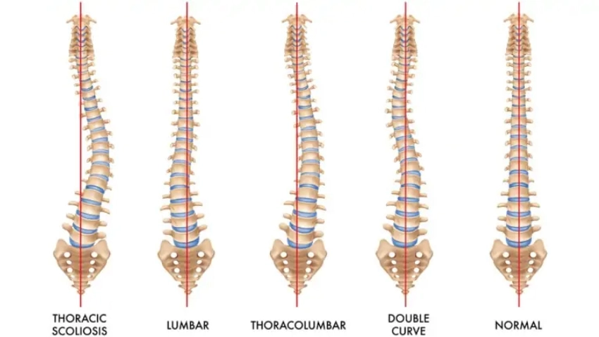 spine diagrams